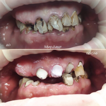 Стоматологическая клиника "МирДент"